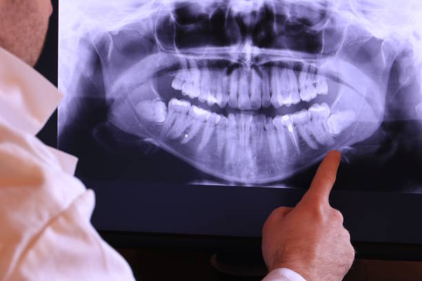Best Emergency Dental Services for Seniors in Bowie, TX