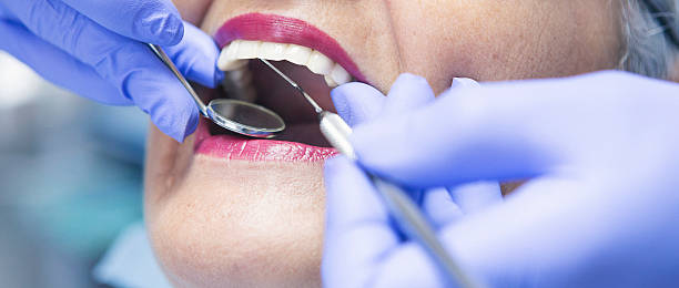 Best Emergency Dentist for Lost Fillings or Crowns in Bowie, TX