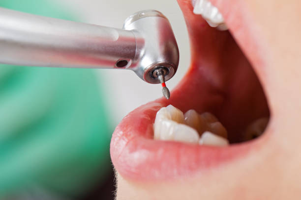 Best Emergency Cosmetic Dentistry in Bowie, TX